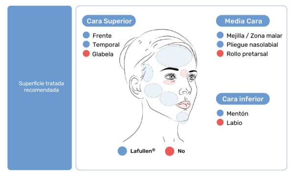 La Fullen Policaprolactona - Imagen 4